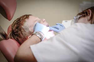 Abcesul dentar: Cauze, simptome și opțiuni de tratament